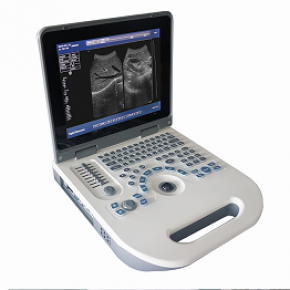M214 Note Book ultrasound Scanner