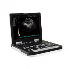 M216 Laptop Ultrasound Scanner