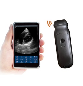 M6PA phased array palm doppler Wireless Ultrasound