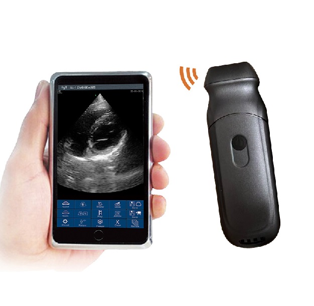 M6PA phased array palm doppler Wireless Ultrasound