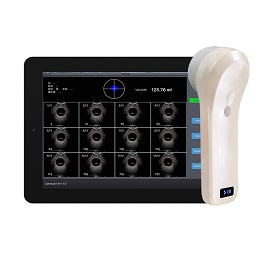MBP2 4D Wireless Bladder Scanner