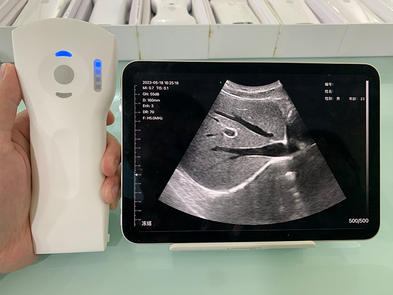 3in1 palm doppler ultrasound 64 Channel 192 Elements