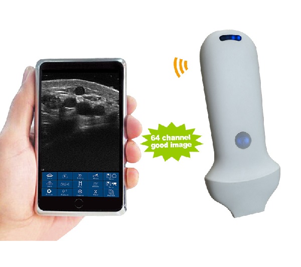  linear palm doppler ultrasound 16-20mhz